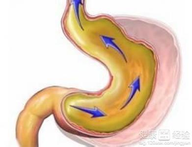 膽汁反流性胃炎的危害