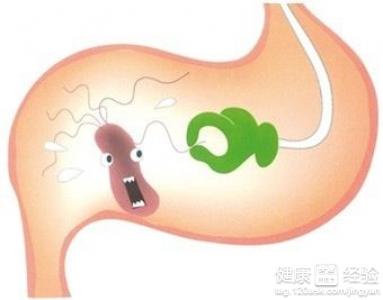 什麼症狀屬於慢性胃炎
