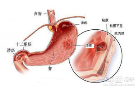 第2步