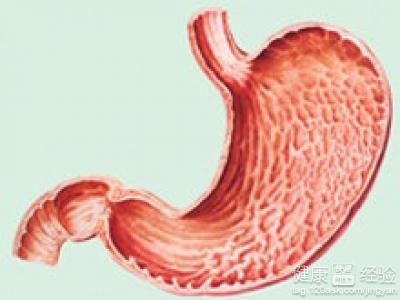 預防慢性胃炎的方法有哪些？