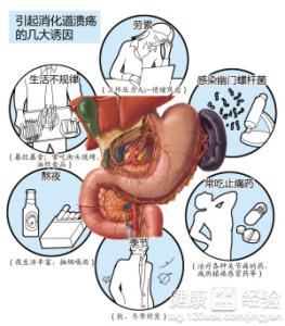 有胃病為何需要檢查C14呼氣試驗