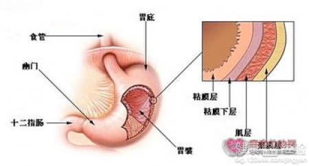 第1步