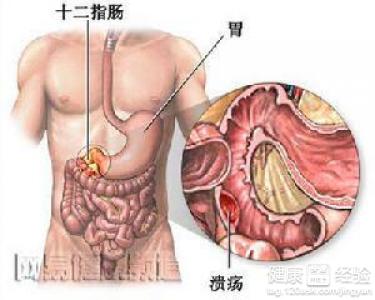 第2步