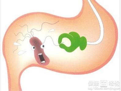 胃潰瘍嚴重了會致癌嗎