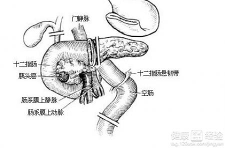 第1步