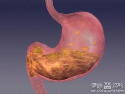 胃下垂，胃潰瘍可以通過B超檢查出來嗎