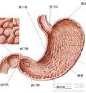 胃潰瘍有哪些並發症？