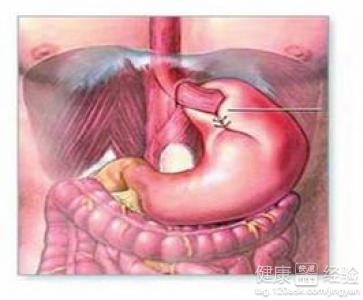慢性胃窦炎如何食療