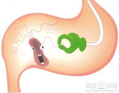 糜爛性胃窦炎的治療方法有哪些