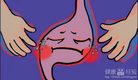 慢性隆起糜爛性胃窦炎手術中該注意些什麼