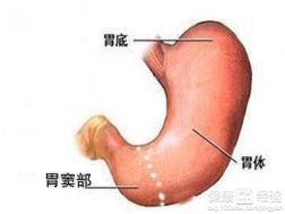 慢性輕度非萎縮性胃炎胃窦炎該如何治療