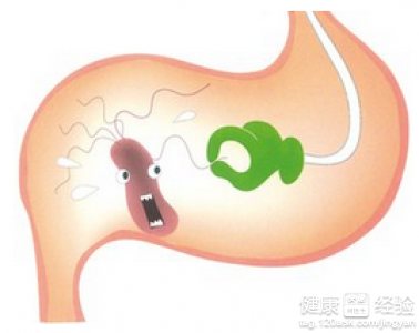 胃窦炎能否引起血常規檢查