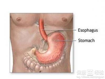 消化性胃潰瘍的病因是什麼