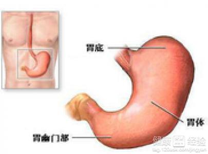 胃潰瘍是怎麼引起的