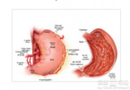 疣狀胃窦炎需要檢查哪些項目