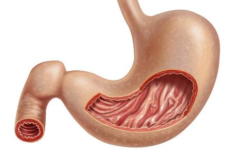 慢性胃炎怎麼引起的 慢性胃炎吃什麼食物好 慢性胃炎飲食