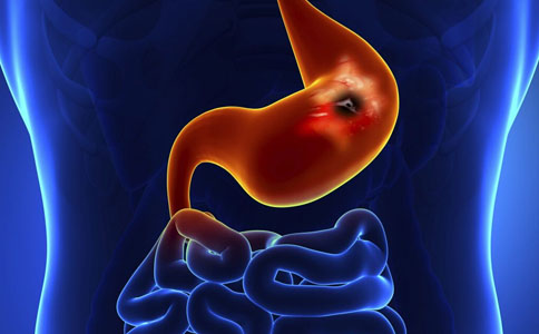 附子理中丸治療胃炎效果如何 附子理中丸成份 胃炎吃什麼藥好