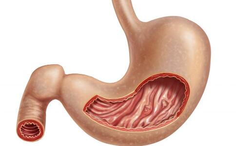 哪些原因引發胃潰瘍 胃潰瘍的症狀有哪些 胃潰瘍怎麼形成的