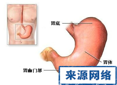 胃潰瘍病因 胃病 幽門螺旋桿菌 胃潰瘍的原因