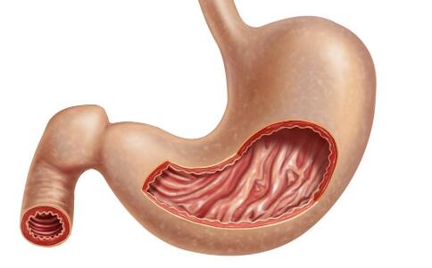 胃下垂怎麼治療 治療胃下垂的方法 如何治療胃下垂