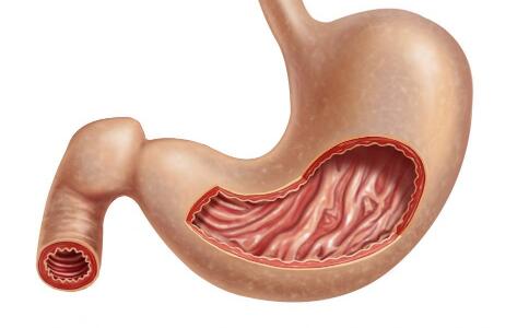 胃下垂如何治療 胃下垂飲食注意事項 治療胃下垂的方法
