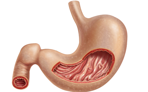 導致胃出血的原因有哪些 胃出血是怎麼引起的 胃出血患者怎麼飲食